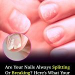 Doctor Reveals 7 Health Conditions You Can Spot By Just Checking Your Nails