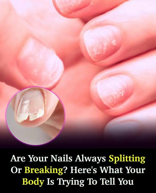 Doctor Reveals 7 Health Conditions You Can Spot By Just Checking Your Nails