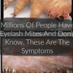 How to spot eyelash mites