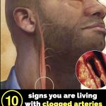 10 signs your arteries might be clogged
